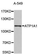 ATP1A1 Antibody in Western Blot (WB)