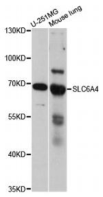 SLC6A4 Antibody in Western Blot (WB)