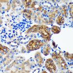 PYCR2 Antibody in Immunohistochemistry (Paraffin) (IHC (P))