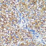 PYCR2 Antibody in Immunohistochemistry (Paraffin) (IHC (P))