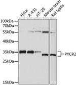 PYCR2 Antibody in Western Blot (WB)