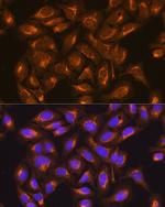 SDHB Antibody in Immunocytochemistry (ICC/IF)