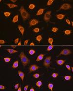 SDHB Antibody in Immunocytochemistry (ICC/IF)