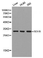 SDHB Antibody in Western Blot (WB)