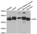 ADSL Antibody in Western Blot (WB)