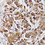 Angiotensinogen Antibody in Immunohistochemistry (Paraffin) (IHC (P))