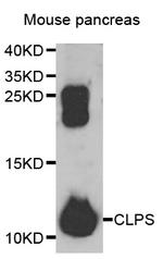 CLPS Antibody in Western Blot (WB)