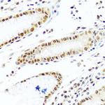 PRP19 Antibody in Immunohistochemistry (Paraffin) (IHC (P))