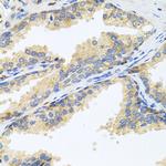 WFDC2 Antibody in Immunohistochemistry (Paraffin) (IHC (P))