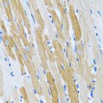 WFDC2 Antibody in Immunohistochemistry (Paraffin) (IHC (P))