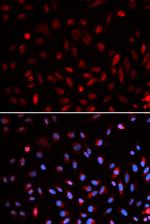 ERCC1 Antibody in Immunocytochemistry (ICC/IF)