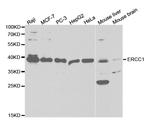 ERCC1 Antibody in Western Blot (WB)