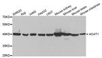 ACAT1 Antibody in Western Blot (WB)