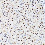 BAF53A Antibody in Immunohistochemistry (Paraffin) (IHC (P))