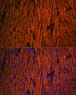 MYL2 Antibody in Immunocytochemistry (ICC/IF)