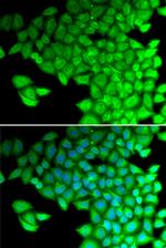 MYL2 Antibody in Immunocytochemistry (ICC/IF)