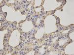 ALDH3A1 Antibody in Immunohistochemistry (Paraffin) (IHC (P))