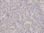 ALDH3A1 Antibody in Immunohistochemistry (Paraffin) (IHC (P))