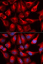 DDX3 Antibody in Immunocytochemistry (ICC/IF)