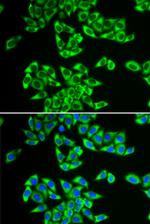 DDX3 Antibody in Immunocytochemistry (ICC/IF)