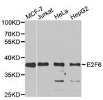 E2F6 Antibody in Western Blot (WB)