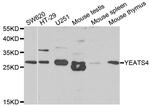 GAS41 Antibody in Western Blot (WB)