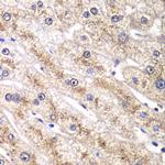 RALB Antibody in Immunohistochemistry (Paraffin) (IHC (P))