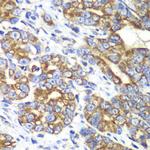 RALB Antibody in Immunohistochemistry (Paraffin) (IHC (P))