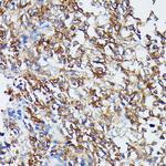 MEK5 Antibody in Immunohistochemistry (Paraffin) (IHC (P))