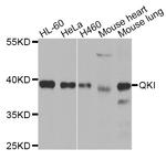 QKI Antibody in Western Blot (WB)