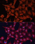 DNAJA2 Antibody in Immunocytochemistry (ICC/IF)