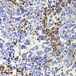 IL-21 Antibody in Immunohistochemistry (Paraffin) (IHC (P))