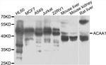 ACAA1 Antibody in Western Blot (WB)