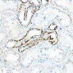 BCAT2 Antibody in Immunohistochemistry (Paraffin) (IHC (P))