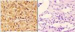 PIK3CG Antibody in Immunohistochemistry (Paraffin) (IHC (P))