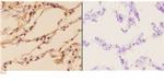 PIK3CG Antibody in Immunohistochemistry (Paraffin) (IHC (P))