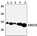 BTLA Antibody in Western Blot (WB)