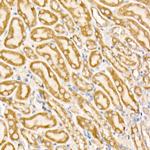 Prohibitin Antibody in Immunohistochemistry (Paraffin) (IHC (P))