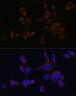 Perforin Antibody in Immunocytochemistry (ICC/IF)