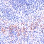 Perforin Antibody in Immunohistochemistry (Paraffin) (IHC (P))