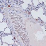 Perforin Antibody in Immunohistochemistry (Paraffin) (IHC (P))