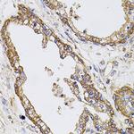 Calpastatin Antibody in Immunohistochemistry (Paraffin) (IHC (P))