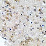 Calpastatin Antibody in Immunohistochemistry (Paraffin) (IHC (P))