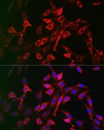 LRP5 Antibody in Immunocytochemistry (ICC/IF)