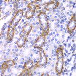 beta Arrestin 1 Antibody in Immunohistochemistry (Paraffin) (IHC (P))