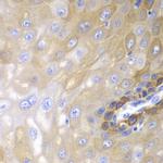 beta Arrestin 1 Antibody in Immunohistochemistry (Paraffin) (IHC (P))