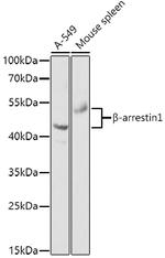 beta Arrestin 1 Antibody in Western Blot (WB)