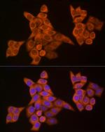 Caspase 8 Antibody in Immunocytochemistry (ICC/IF)