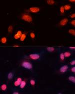 SIRT1 Antibody in Immunocytochemistry (ICC/IF)