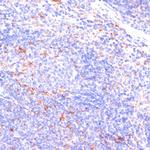 IKK epsilon Antibody in Immunohistochemistry (Paraffin) (IHC (P))